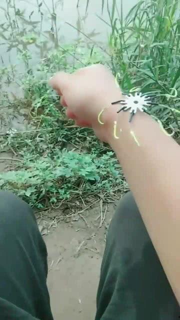 吃瓜后脚疼,揭秘吃瓜后的健康隐患